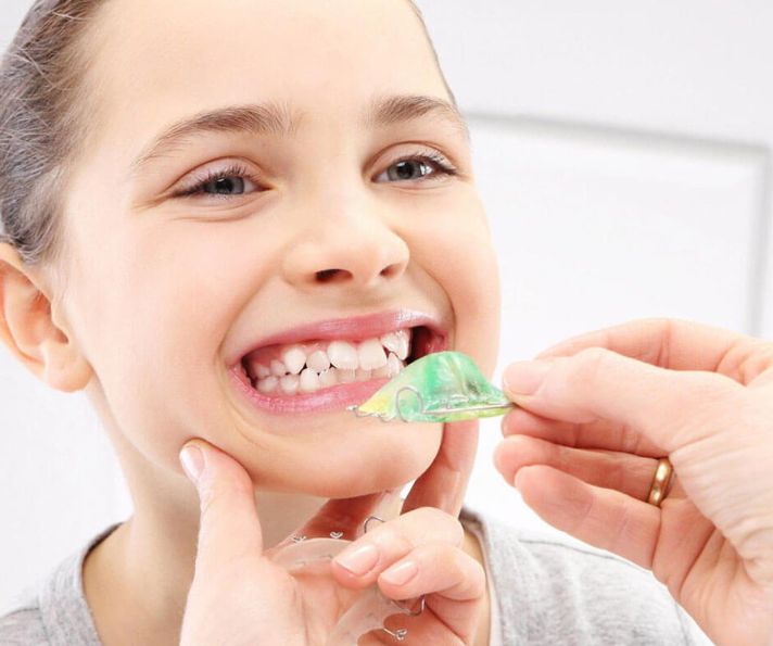 Особенности ценообразования на выравнивание зубов у детей